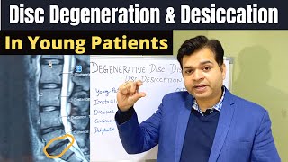 Disc Degeneration L5 S1 Disc Desiccation Disc Degeneration Causes DDDDegenerative Disc Treatment [upl. by Stevens]