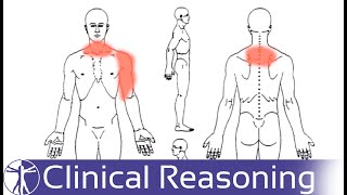 Screening for Visceral Referred Pain in the Cervical Spine [upl. by Dihsar541]