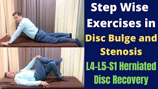 Exercises For Herniated Disc Disc Bulge L4L5S1 Step Wise Treatment for Slipped Disc Recovery [upl. by Akilaz]