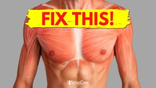 How to Fix Chest Muscle Tightness in 30 SECONDS [upl. by Henni818]