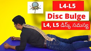 L4L5 Disc Bulge exercises  Sciatica relief herniated disc exercises L4L5 [upl. by Aihsel]