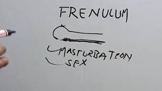 Penile Frenulum How to break Frenulum near penis shaft and head explained in hindi [upl. by Heall545]