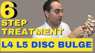 6 Step L4 L5 Disc Bulge Treatment L4 L5 Bulging Disc Treatment by Dr Walter Salubro [upl. by Otreblanauj]