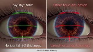 Upgrade your Astigmatic Patients to MyDay® toric [upl. by Melisse]