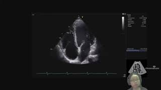 243d Types of Ultrasound Scans in Diagnostic Imaging  A2 Medical  Cambridge A Level Physics [upl. by Anitnuahs]