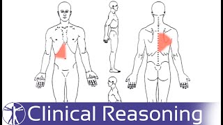 Screening for Visceral Referred Pain in the Thoracic Spine [upl. by Nirro101]